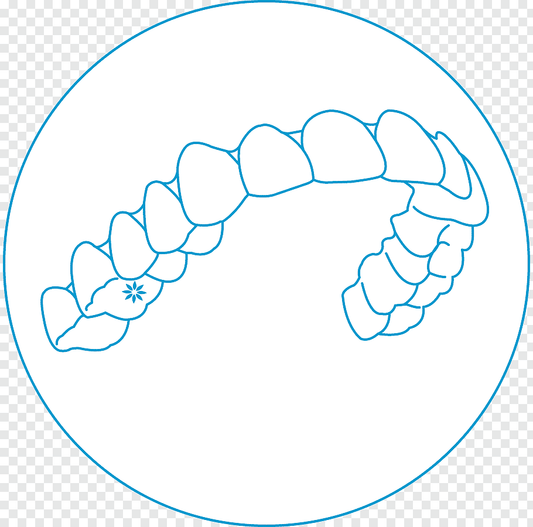 Phase 1 - Smart™ Clear Aligner System - Treatment Planning and Manufacturing