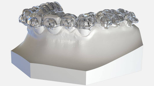 Indirect Bonding Trays