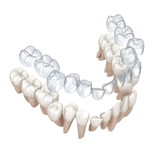Smart™ Clear Aligner System - Design Services and Manufacturing
